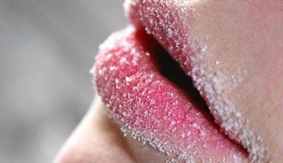 Что делать, если трескаются губы?