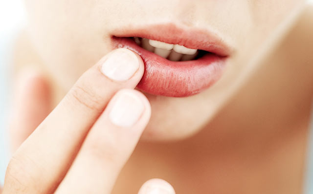 Как увлажнить сухие губы и устранить шелушение губ